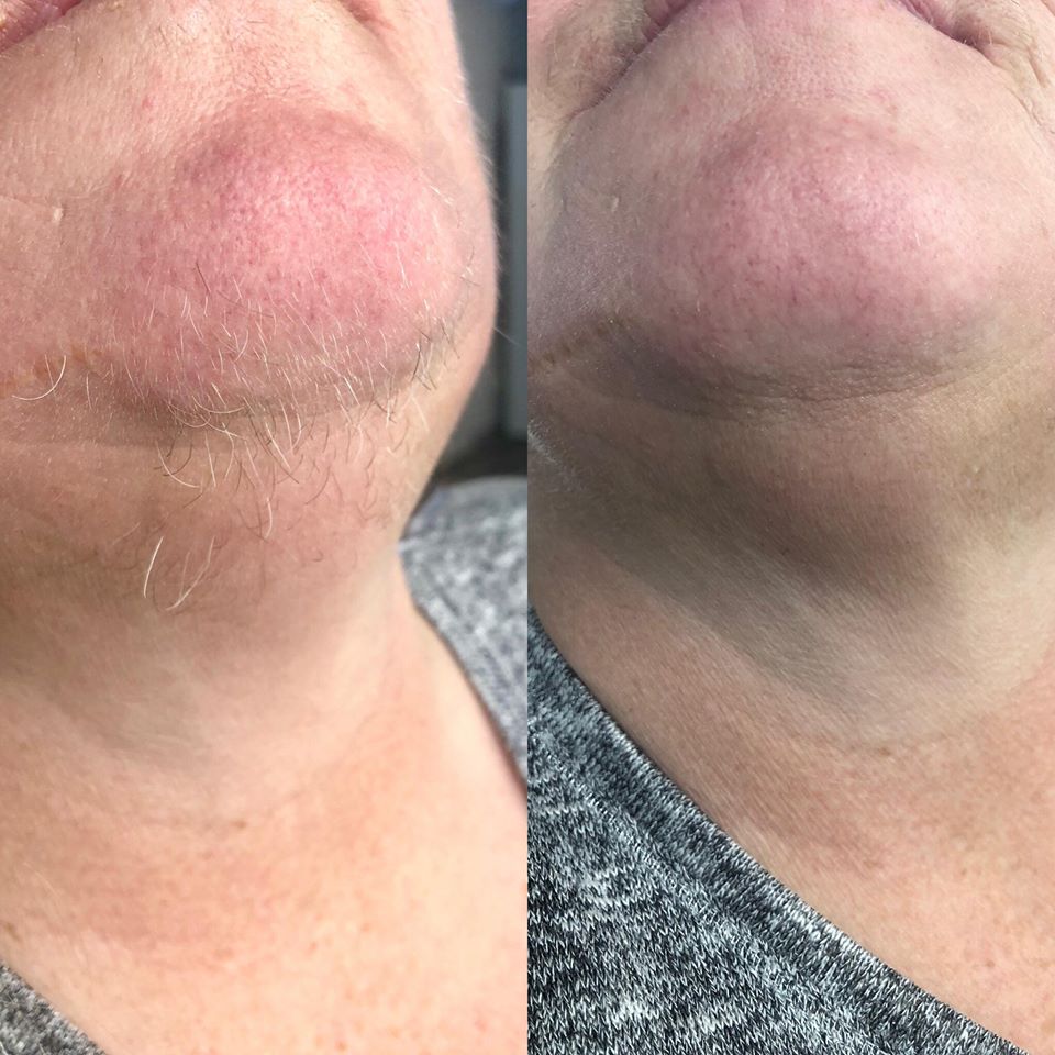 Töfratækið frá NoName Beauty