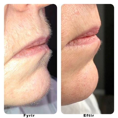 Töfratækið frá NoName Beauty