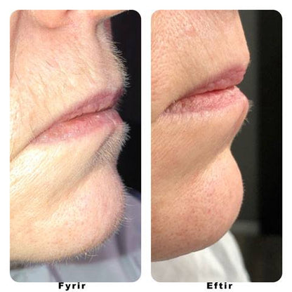 Töfratækið frá NoName Beauty