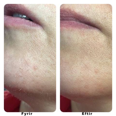 Töfratækið frá NoName Beauty