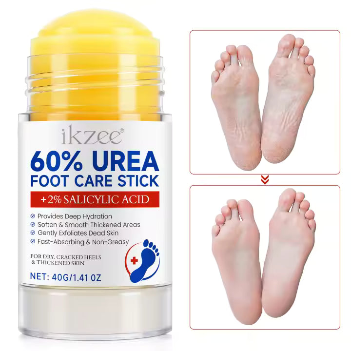 Fótakrem með 60% UREA 2% Salicylic Acid